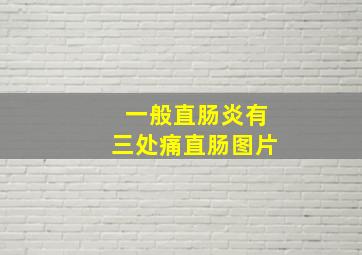 一般直肠炎有三处痛直肠图片