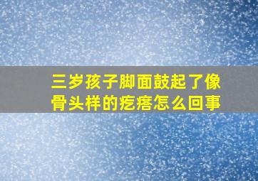 三岁孩子脚面鼓起了像骨头样的疙瘩怎么回事