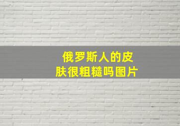 俄罗斯人的皮肤很粗糙吗图片