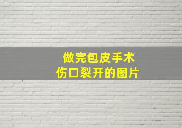 做完包皮手术伤口裂开的图片