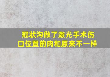 冠状沟做了激光手术伤口位置的肉和原来不一样