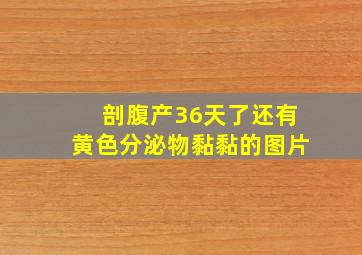 剖腹产36天了还有黄色分泌物黏黏的图片