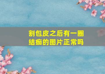 割包皮之后有一圈结痂的图片正常吗