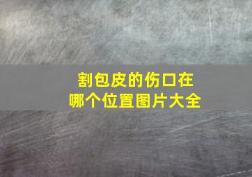 割包皮的伤口在哪个位置图片大全