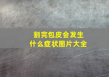 割完包皮会发生什么症状图片大全