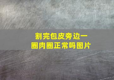 割完包皮旁边一圈肉圈正常吗图片