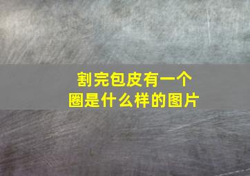 割完包皮有一个圈是什么样的图片