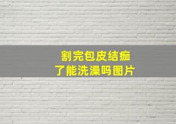 割完包皮结痂了能洗澡吗图片