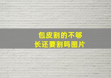 包皮割的不够长还要割吗图片