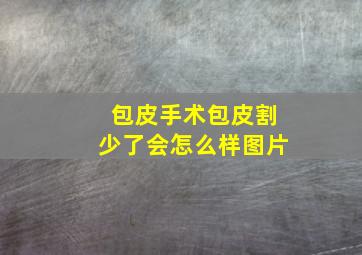 包皮手术包皮割少了会怎么样图片