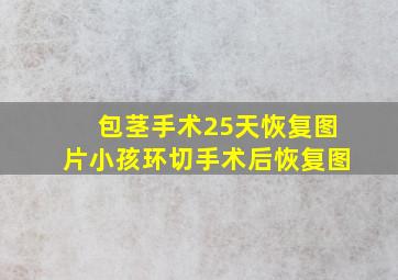 包茎手术25天恢复图片小孩环切手术后恢复图