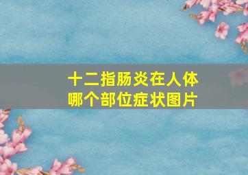 十二指肠炎在人体哪个部位症状图片