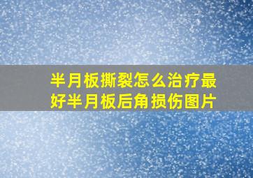 半月板撕裂怎么治疗最好半月板后角损伤图片