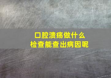 口腔溃疡做什么检查能查出病因呢