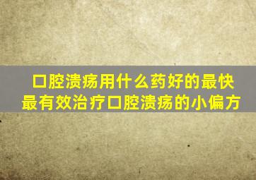 口腔溃疡用什么药好的最快最有效治疗口腔溃疡的小偏方