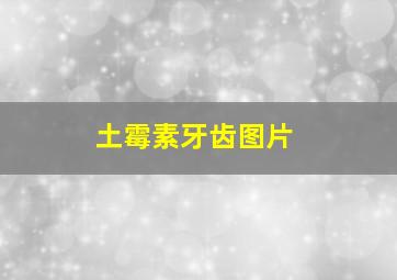 土霉素牙齿图片