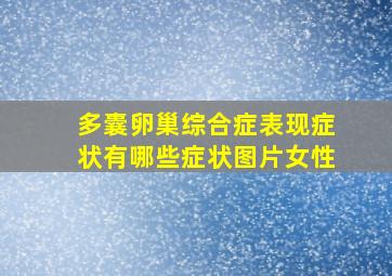 多囊卵巢综合症表现症状有哪些症状图片女性