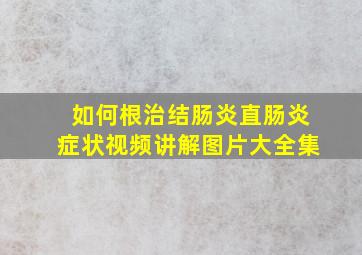 如何根治结肠炎直肠炎症状视频讲解图片大全集