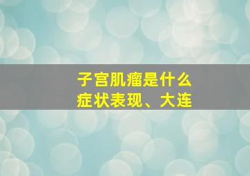 子宫肌瘤是什么症状表现、大连