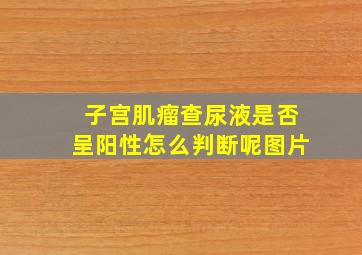 子宫肌瘤查尿液是否呈阳性怎么判断呢图片