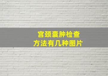 宫颈囊肿检查方法有几种图片