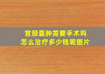 宫颈囊肿需要手术吗怎么治疗多少钱呢图片