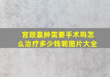 宫颈囊肿需要手术吗怎么治疗多少钱呢图片大全