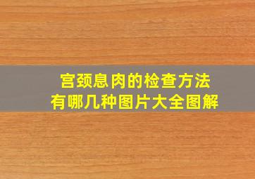 宫颈息肉的检查方法有哪几种图片大全图解