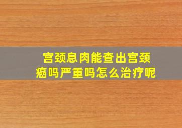 宫颈息肉能查出宫颈癌吗严重吗怎么治疗呢