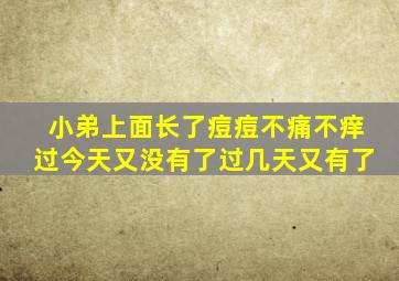 小弟上面长了痘痘不痛不痒过今天又没有了过几天又有了