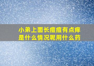 小弟上面长痘痘有点痒是什么情况呢用什么药