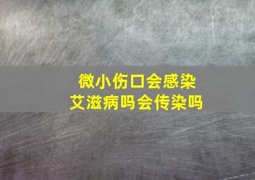 微小伤口会感染艾滋病吗会传染吗