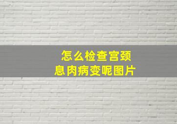 怎么检查宫颈息肉病变呢图片