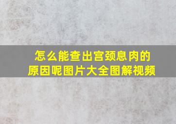 怎么能查出宫颈息肉的原因呢图片大全图解视频