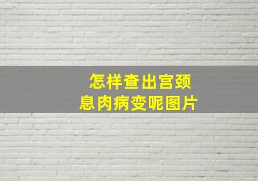 怎样查出宫颈息肉病变呢图片