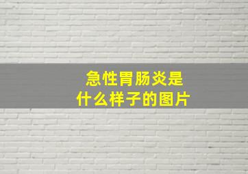 急性胃肠炎是什么样子的图片