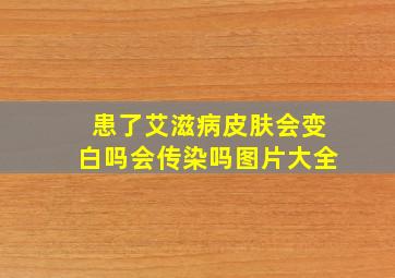 患了艾滋病皮肤会变白吗会传染吗图片大全