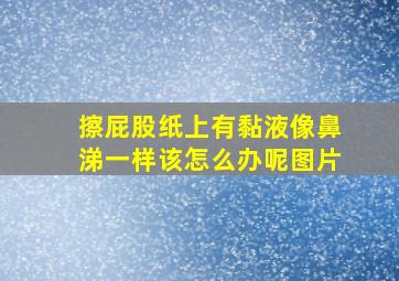 擦屁股纸上有黏液像鼻涕一样该怎么办呢图片