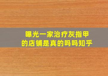 曝光一家治疗灰指甲的店铺是真的吗吗知乎