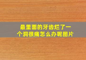 最里面的牙齿烂了一个洞很痛怎么办呢图片