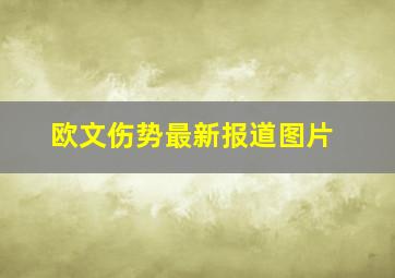 欧文伤势最新报道图片