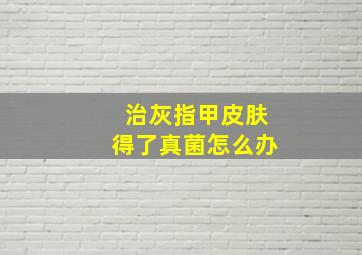 治灰指甲皮肤得了真菌怎么办