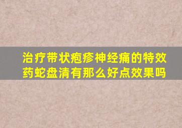 治疗带状疱疹神经痛的特效药蛇盘清有那么好点效果吗