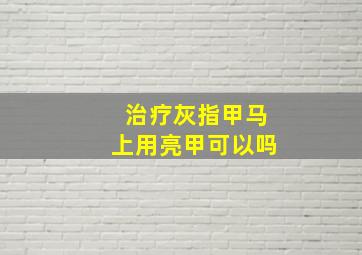 治疗灰指甲马上用亮甲可以吗