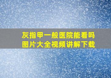 灰指甲一般医院能看吗图片大全视频讲解下载