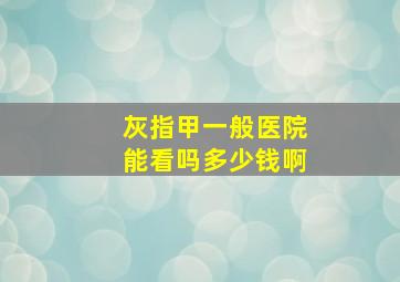 灰指甲一般医院能看吗多少钱啊