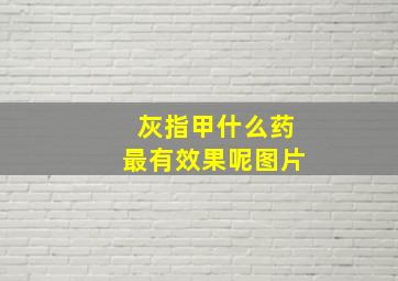 灰指甲什么药最有效果呢图片