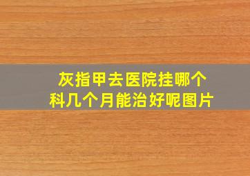 灰指甲去医院挂哪个科几个月能治好呢图片