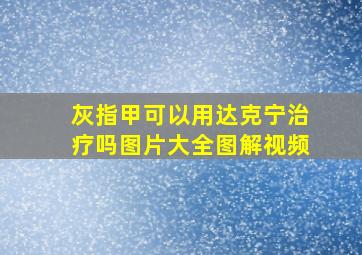 灰指甲可以用达克宁治疗吗图片大全图解视频