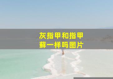 灰指甲和指甲藓一样吗图片